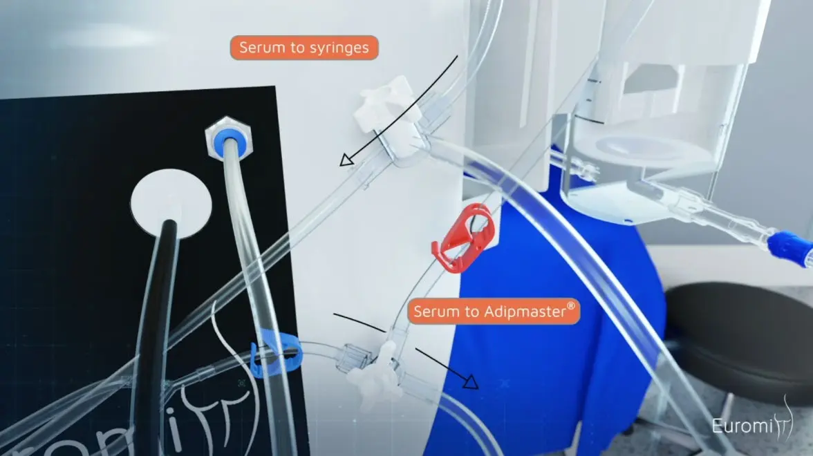 The infiltration kit during lipoinfiltration