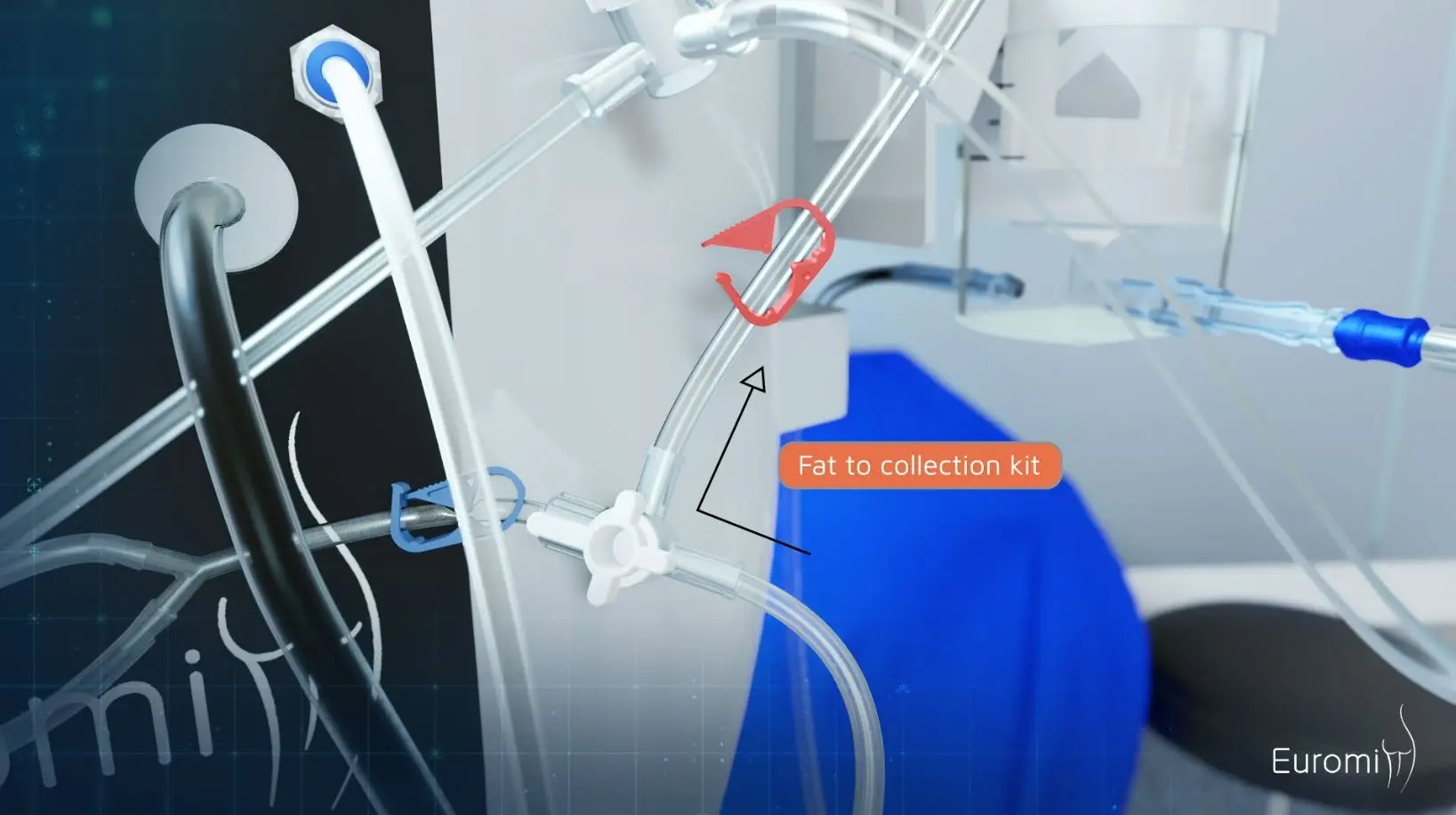 the valves of the Infiltration kit